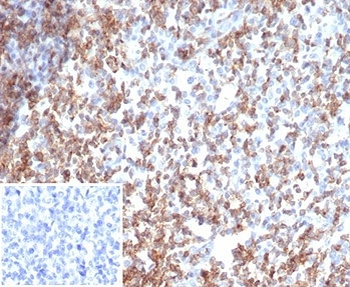 Recombinant CD2 Antibody / Lymphocyte Function Antigen 2 / LFA-2