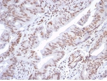ATRX Antibody