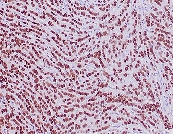 GATA3 Antibody