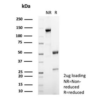 Steroidogenic Factor 1 Antibody / SF-1 / NR5A1