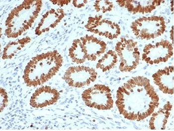 SATB2 Antibody