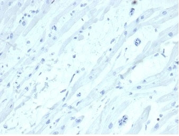 SATB2 Antibody