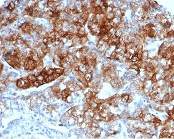 CD13 Antibody / ANPEP