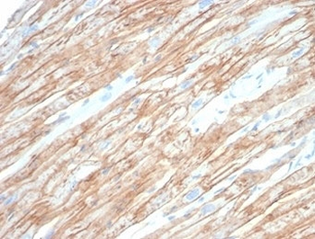 DMD Antibody / Dystrophin