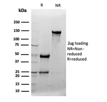 Clusterin Antibody / Apolipoprotein J / APO-J