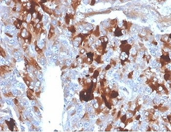 Clusterin Antibody / Apolipoprotein J / APO-J