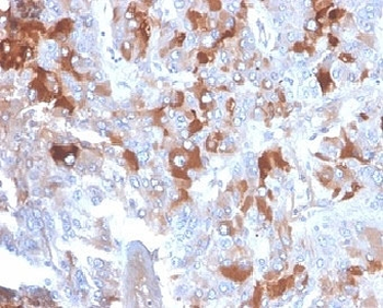 Clusterin Antibody / Apolipoprotein J / APO-J
