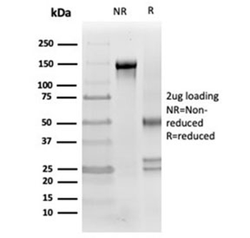 Clusterin Antibody / Apolipoprotein J / APO-J