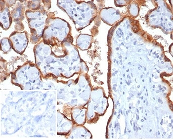 HCG-beta Antibody