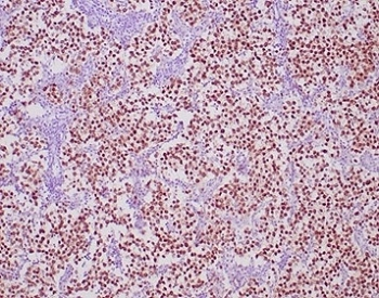 Oct4 Antibody / POU5F1