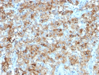 StAR Antibody / Steroidogenic acute regulatory protein