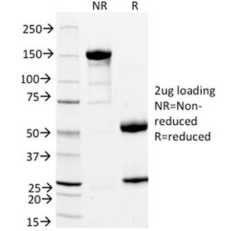 StAR Antibody / Steroidogenic acute regulatory protein