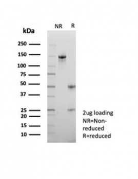 ATRX Antibody / RAD54