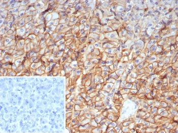 CD99 Antibody / MIC2