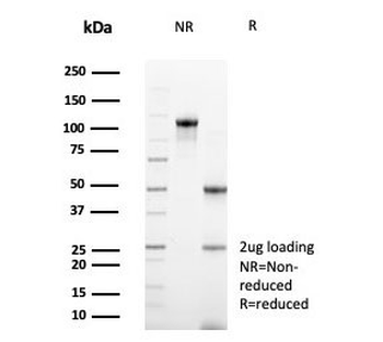 CD99 Antibody / MIC2
