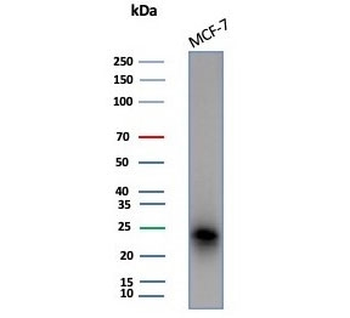 CD99 Antibody / MIC2