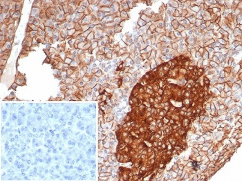 CD99 Antibody / MIC2