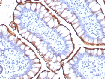 ACE2 Antibody / Angiotensin-Converting Enzyme 2