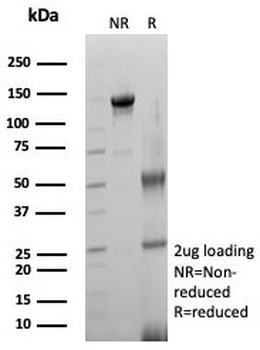 ACE2 Antibody / Angiotensin-Converting Enzyme 2