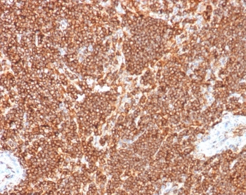 S100G Antibody / Calbindin D9K
