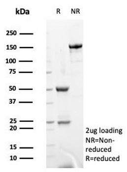 S100G Antibody / Calbindin D9K
