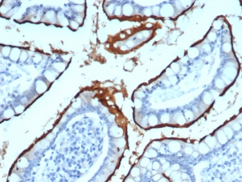 ACE2 / Angiotensin I Converting Enzyme 2 Antibody