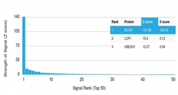 BCOR Antibody / BCL-6 corepressor