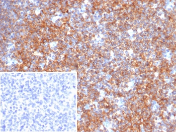 BCOR Antibody / BCL-6 corepressor