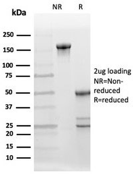 BCOR Antibody / BCL-6 corepressor