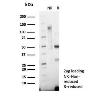 Synaptophysin Antibody