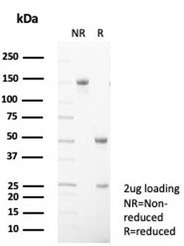 CD99 Antibody / MIC2