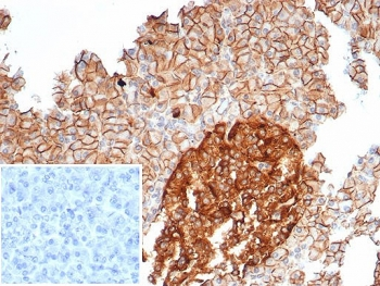 CD99 Antibody / MIC2