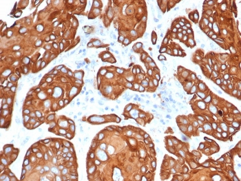 Tissue Inhibitor of Metalloproteinase 1 Antibody / TIMP1