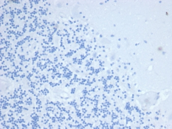 Tissue Inhibitor of Metalloproteinase 1 Antibody / TIMP1