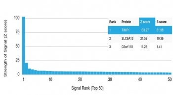 Tissue Inhibitor of Metalloproteinase 1 Antibody / TIMP1