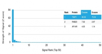 TIMP1 Antibody / Tissue Inhibitor of Metalloproteinase 1