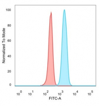 KDM5C Antibody / JARID1C / SMCX
