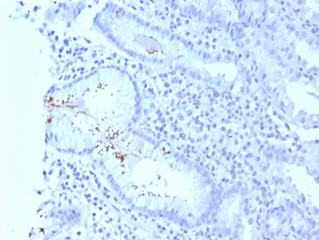 H pylori Antibody (Catalase) / Helicobacter pylori