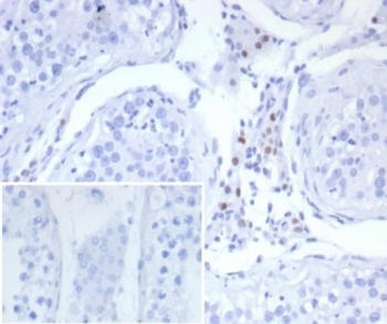 Steroidogenic Factor 1 Antibody / SF-1 / NR5A1
