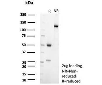 Steroidogenic Factor 1 Antibody / SF-1 / NR5A1