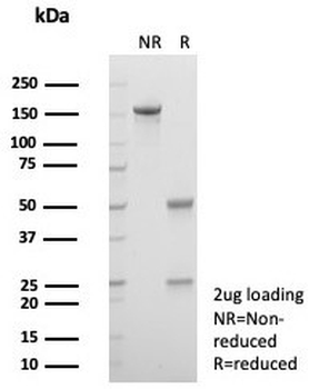 Alpha 1 microglobulin Antibody / AMBP / Bikunin