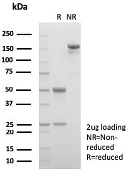 Alpha 1 microglobulin Antibody / AMBP / Bikunin