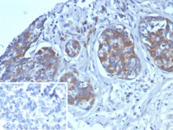 Alpha 1 microglobulin Antibody / AMBP / Bikunin