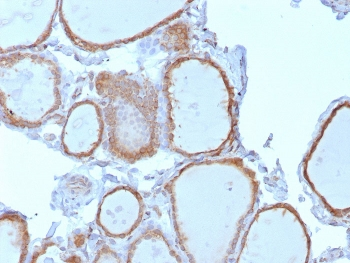 TrkB Antibody / NTRK2