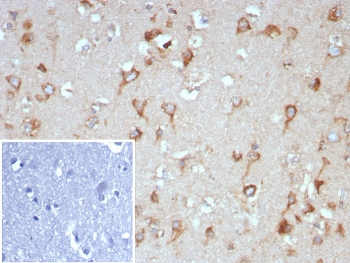 TrkB Antibody / NTRK2