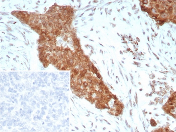 TrkB Antibody / NTRK2