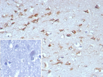 TrkB Antibody / NTRK2