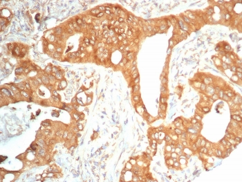 TrkB Antibody / NTRK2