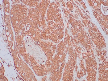TrkB Antibody / NTRK2