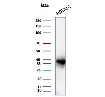 PD-L1 Antibody / B7-H1 / CD274